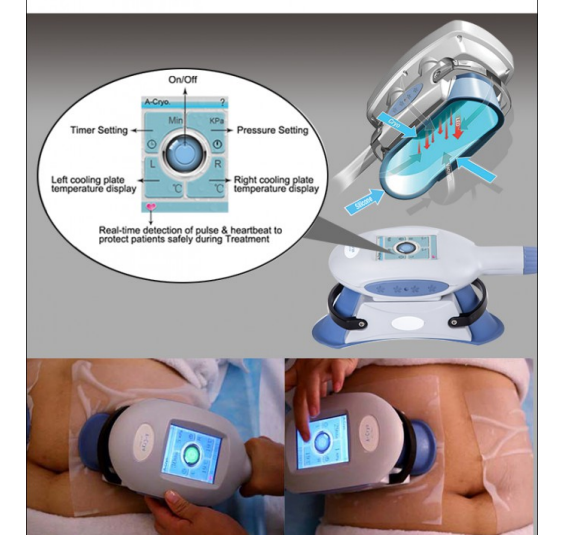 Urządzenie Kriolipoliza MED 340